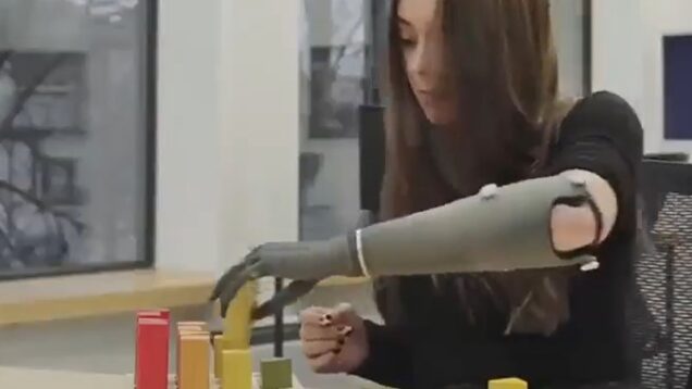 FI-EsperBionics